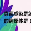 真菌感染是怎么引起的（上呼吸道感染最常见的病原体是）