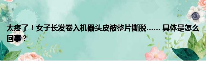 太疼了！女子长发卷入机器头皮被整片撕脱…… 具体是怎么回事？