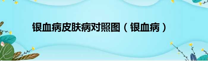 银血病皮肤病对照图（银血病）