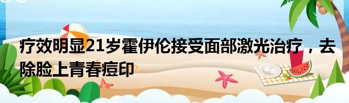 疗效明显21岁霍伊伦接受面部激光治疗，去除脸上青春痘印